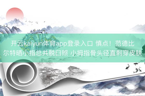 开云kaiyun体育app登录入口 慎点！范德比尔特晒小指总共脱臼照 小拇指骨头径直刺穿皮肤